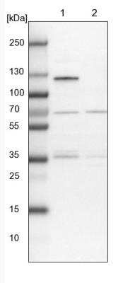 Western Blot: RNF111 Antibody [NBP1-94140]