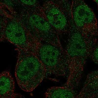 Immunocytochemistry/ Immunofluorescence: RNF113A Antibody [NBP2-69024]