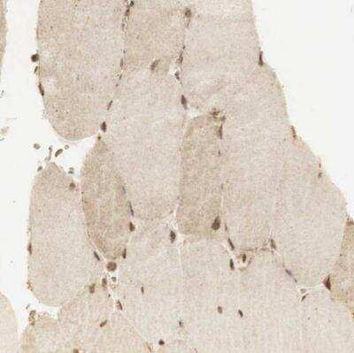 Immunohistochemistry-Paraffin: RNF113A Antibody [NBP1-85378]
