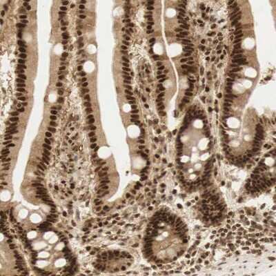 Immunohistochemistry-Paraffin: RNF113A Antibody [NBP1-85378]