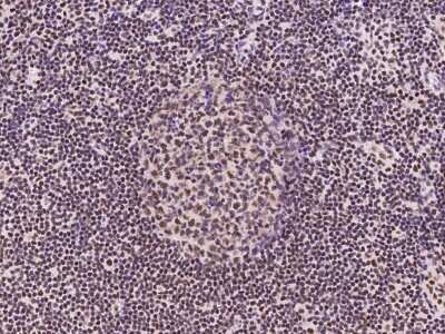 Immunohistochemistry-Paraffin: RNF113A Antibody [NBP2-97642]