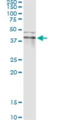 Immunoprecipitation: RNF113B Antibody (2B11) [H00140432-M02]