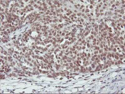 Immunohistochemistry: RNF113B Antibody (OTI7A1) - Azide and BSA Free [NBP2-73921]