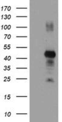 Western Blot: RNF113B Antibody (OTI7A1)Azide and BSA Free [NBP2-73921]