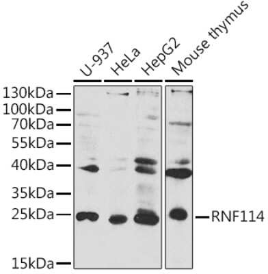 Western Blot: RNF114 AntibodyBSA Free [NBP3-15333]