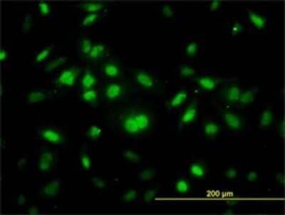 Immunocytochemistry/ Immunofluorescence: RNF12 Antibody (1G10) [H00051132-M01]