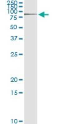 Immunoprecipitation: RNF12 Antibody (1G10) [H00051132-M01]