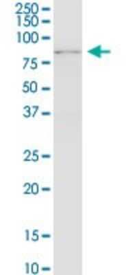 Western Blot: RNF12 Antibody (1G10) [H00051132-M01]