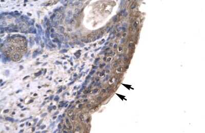 Immunohistochemistry: RNF12 Antibody [NBP3-10928]