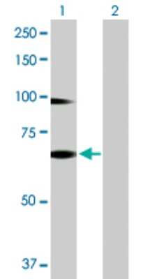 Western Blot: RNF12 Antibody [H00051132-B01P]