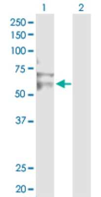 Western Blot: RNF12 Antibody [H00051132-D01P]