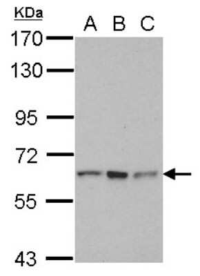 Western Blot: RNF12 Antibody [NBP2-20175]