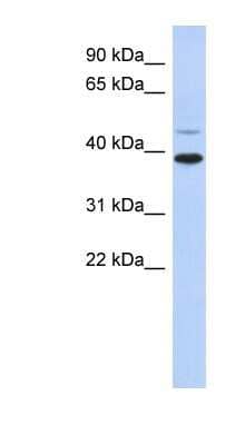 Western Blot: RNF121 Antibody [NBP1-59638]