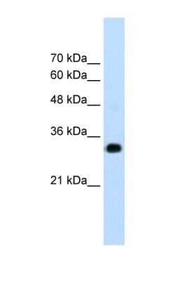 Western Blot: RNF121 Antibody [NBP1-59772]