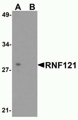 Western Blot: RNF121 AntibodyBSA Free [NBP2-81947]