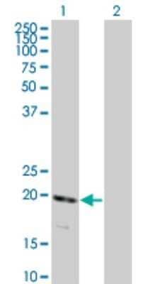 Western Blot: RNF122 Antibody (5E5) [H00079845-M01]