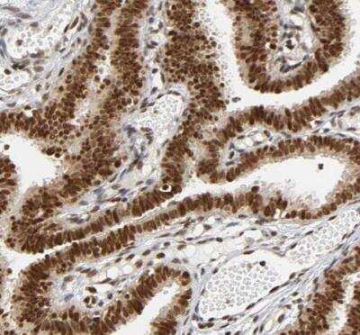 Immunohistochemistry-Paraffin: RNF122 Antibody [NBP1-82295]