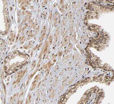 Immunohistochemistry-Paraffin: RNF122 Antibody [NBP1-82295]