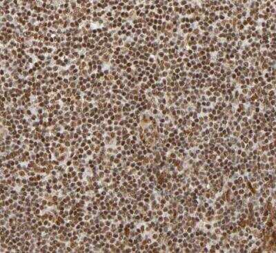 Immunohistochemistry-Paraffin: RNF122 Antibody [NBP1-82295]