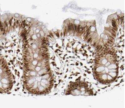 Immunohistochemistry-Paraffin: RNF122 Antibody [NBP1-82295]