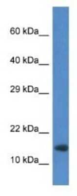 Western Blot: RNF122 Antibody [NBP1-74191]