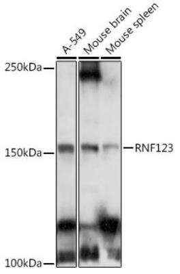 Western Blot: RNF123 AntibodyAzide and BSA Free [NBP2-93401]