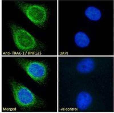 Immunocytochemistry/ Immunofluorescence: RNF125 Antibody [NBP2-78703]