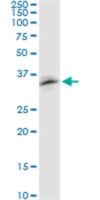 Western Blot: RNF126 Antibody (3F11) [H00055658-M04]