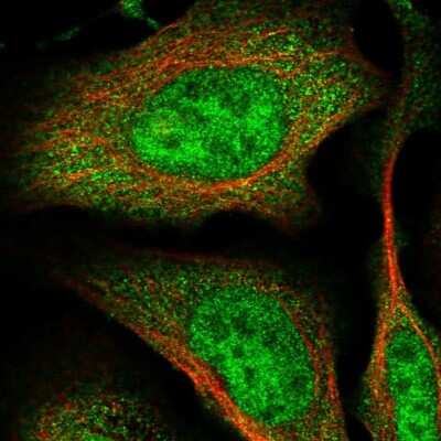 Immunocytochemistry/ Immunofluorescence: RNF126 Antibody [NBP1-83645]