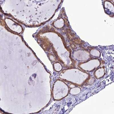Immunohistochemistry-Paraffin: RNF126 Antibody [NBP1-83645]