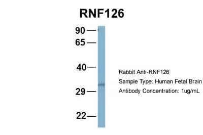 Western Blot: RNF126 Antibody [NBP1-55058]