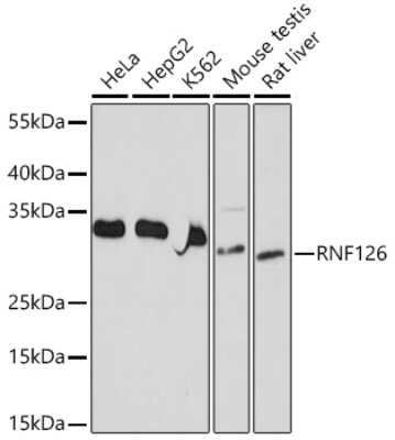 Western Blot: RNF126 AntibodyAzide and BSA Free [NBP3-15952]