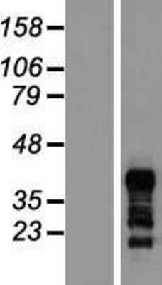 Western Blot: RNF126 Overexpression Lysate [NBL1-15417]