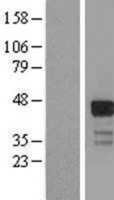 Western Blot: RNF126 Overexpression Lysate [NBL1-15418]