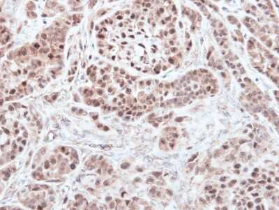 Immunohistochemistry-Paraffin: RNF13 Antibody [NBP1-31251]