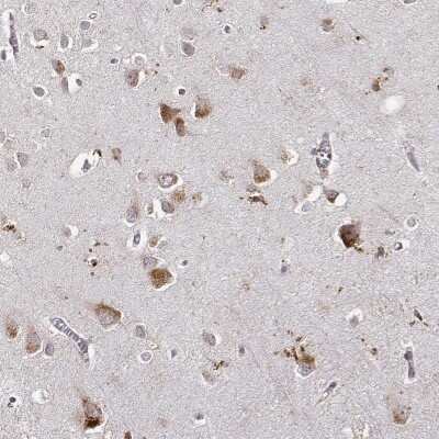 Immunohistochemistry-Paraffin: RNF13 Antibody [NBP2-57493]
