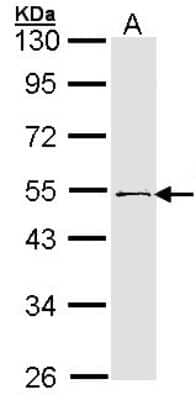 Western Blot: RNF13 Antibody [NBP1-31251]