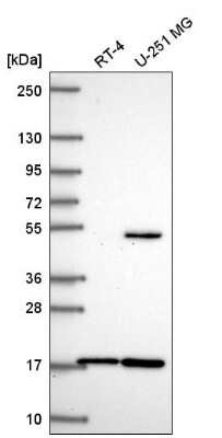 Western Blot: RNF13 Antibody [NBP2-57493]