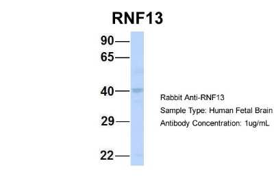 Western Blot: RNF13 Antibody [NBP2-88161]