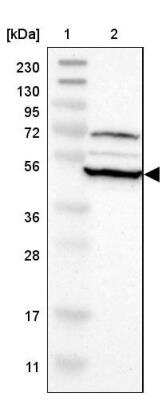 Western Blot: RNF130 Antibody [NBP1-81858]