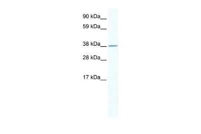 Western Blot: RNF130 Antibody [NBP2-83454]