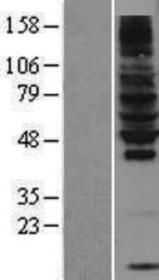 Western Blot: RNF130 Overexpression Lysate [NBL1-15421]