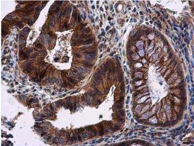 Immunohistochemistry-Paraffin: RNF133 Antibody [NBP2-20176]