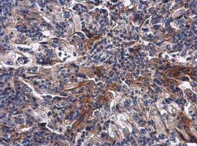 Immunohistochemistry-Paraffin: RNF133 Antibody [NBP2-20176]
