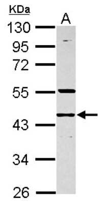 Western Blot: RNF133 Antibody [NBP2-20176]