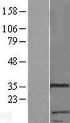 Western Blot: RNF133 Overexpression Lysate [NBP2-05594]