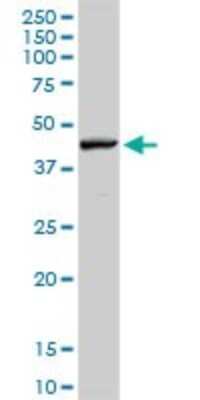 Western Blot: RNF135 Antibody [H00084282-D01P]