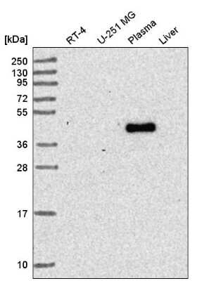 Western Blot: RNF135 Antibody [NBP2-56223]