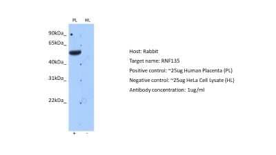 Western Blot: RNF135 Antibody [NBP2-88163]