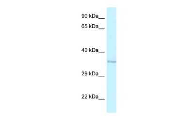 Western Blot: RNF135 Antibody [NBP2-88164]